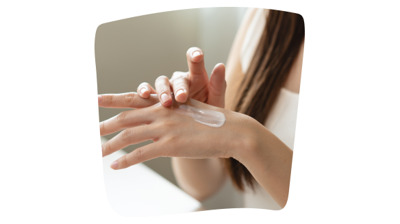 Donna si applica una crema idratante sulla mano dove portava un cerotto che le ha causato una reazione allergica cutanea. Donna si applica una crema idratante sulla mano dove portava un cerotto che le ha causato una reazione allergica cutanea.